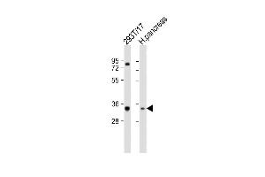 All lanes : Anti-SHOX Antibody (N-term) at 1:2000 dilution Lane 1: 293T/17 whole cell lysate Lane 2: human pancreas lysate Lysates/proteins at 20 μg per lane. (SHOX 抗体  (N-Term))