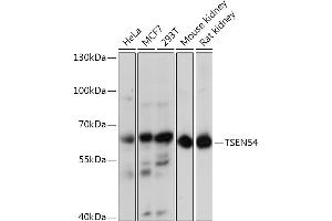 Western blot analysis of extracts of various cell lines, using TSEN54 Rabbit pAb (ABIN7271007) at 1:3000 dilution. (TSEN54 抗体  (AA 1-300))