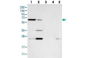 Western blot analysis of Lane 1: RT-4, Lane 2: U-251 MG, Lane 3: Human Plasma, Lane 4: Liver, Lane 5: Tonsil with KLHDC10 polyclonal antibody  at 1:250-1:500 dilution. (KLHDC10 抗体)