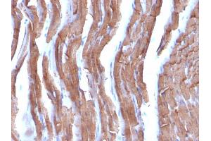 Formalin-fixed, paraffin-embedded Rat Heart stained with Muscle Specific Actin Mouse Monoclonal Antibody (MSA/953). (ACTA1/ACTA2A/ACTG2 抗体)