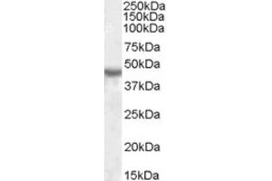 Western Blotting (WB) image for anti-Potassium Inwardly-Rectifying Channel, Subfamily J, Member 1 (KCNJ1) (Internal Region) antibody (ABIN2464210) (KCNJ1 抗体  (Internal Region))
