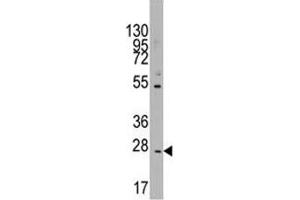 Western blot analysis of CD8B in K562 lysate (CD8B 抗体  (AA 64-92))
