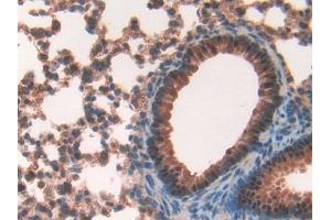 DAB staining on IHC-P; Samples: Mouse Lung Tissue (FKBP8 抗体  (AA 110-329))