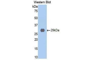 Western Blotting (WB) image for anti-Cathepsin D (CTSD) (AA 169-408) antibody (ABIN1858545) (Cathepsin D 抗体  (AA 169-408))