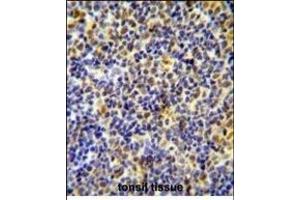 Immunohistochemistry (Paraffin-embedded Sections) (IHC (p)) image for anti-IKAROS Family Zinc Finger 1 (Ikaros) (IKZF1) (AA 415-444), (C-Term) antibody (ABIN654180)