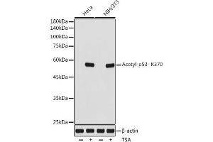 Western blot analysis of extracts of various cell lines, using Acetyl-p53- K370 antibody (ABIN7271082) at 1:1000 dilution. (p53 抗体  (acLys370))