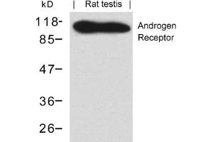 Image no. 1 for anti-Androgen Receptor (AR) (AA 648-652) antibody (ABIN401550) (Androgen Receptor 抗体  (AA 648-652))