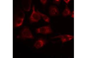 ABIN6275234 staining Hela by IF/ICC. (MRPS22 抗体  (C-Term))