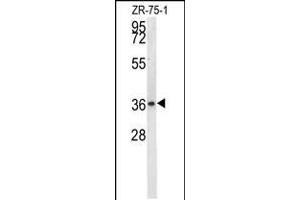 Western blot analysis in ZR-75-1 cell line lysates (35ug/lane). (Nitrilase 1 抗体  (C-Term))