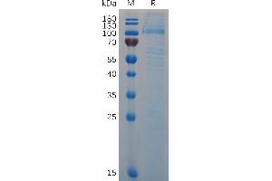 SDS-PAGE (SDS) image for Von Willebrand Factor (VWF) (AA 23-763) protein (His tag) (ABIN7092869)
