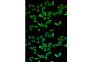 Immunofluorescence analysis of U2OS cells using PRDX5 antibody. (Peroxiredoxin 5 抗体  (AA 53-214))