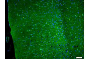 Paraformaldehyde-fixed, paraffin embedded Mouse brain, Antigen retrieval by boiling in sodium citrate buffer (pH6. (DLGAP4 抗体  (AA 261-370))