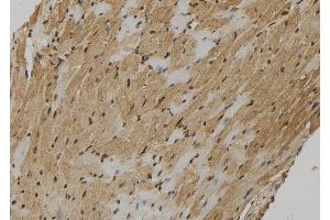 ABIN6261775 and ABIN6278998 at 1/100 staining Mouse heart tissue by IHC-P. (FMR1NB 抗体  (C-Term))