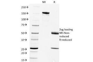 SDS-PAGE Analysis of Purified, BSA-Free Rabies Virus Antibody (clone Rab-50). (Rabies Virus 抗体)