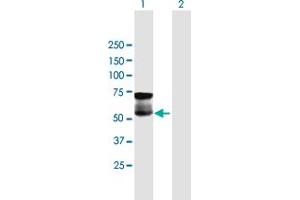 Western Blot analysis of GGT1 expression in transfected 293T cell line by GGT1 MaxPab polyclonal antibody. (GGT1 抗体  (AA 1-569))