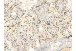 ABIN6261114 and ABIN6266520 at 1/100 staining human normal placenta tissue by IHC-P. (Cullin 1 抗体  (C-Term))