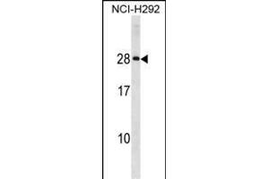 HLA-DQA2 Antibody (Center) (ABIN1881421 and ABIN2839048) western blot analysis in NCI- cell line lysates (35 μg/lane). (HLA-DQA2 抗体  (AA 39-66))