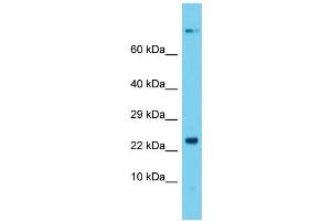 Host: Rabbit  Target Name: Dctn5  Sample Tissue: Rat Stomach lysates  Antibody Dilution: 1.