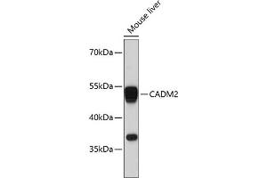 Western blot analysis of extracts of mouse liver, using C antibody (ABIN6129649, ABIN6137839, ABIN6137840 and ABIN6215420) at 1:3000 dilution. (CADM2 抗体  (AA 220-335))