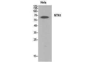 Western Blot (WB) analysis of HeLa cells using Netrin-1 Polyclonal Antibody. (Netrin 1 抗体  (Internal Region))
