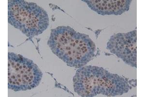 Detection of MUC1 in Rat Testis Tissue using Polyclonal Antibody to Mucin 1 (MUC1) (MUC1 抗体  (AA 404-655))