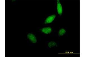 Immunofluorescence of purified MaxPab antibody to ELF2 on HeLa cell. (ELF2 抗体  (AA 1-581))