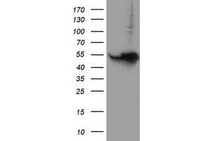 Western Blotting (WB) image for anti-Histidyl-tRNA Synthetase 2, Mitochondrial (Putative) (HARS2) antibody (ABIN1498586) (HARS2 抗体)