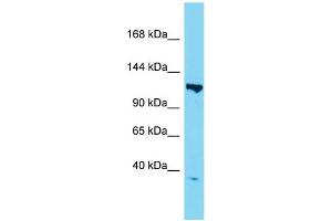Western Blotting (WB) image for anti-TAF3 RNA Polymerase II, TATA Box Binding Protein (TBP)-Associated Factor, 140kDa (TAF3) (N-Term) antibody (ABIN2780183)
