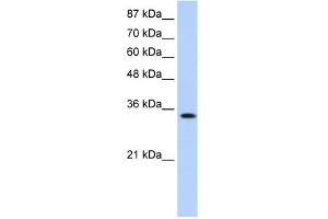 WB Suggested Anti-MBNL1 Antibody Titration:  0. (MBNL1 抗体  (Middle Region))