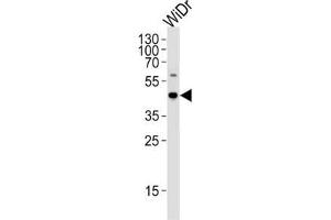 Western Blotting (WB) image for anti-Chromosome 9 Open Reading Frame 72 (C9ORF72) antibody (ABIN2997029) (C9ORF72 抗体)