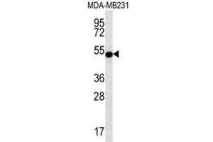 Western Blotting (WB) image for anti-Signal Transducing Adaptor Family Member 2 (STAP2) antibody (ABIN2996919) (STAP2 抗体)