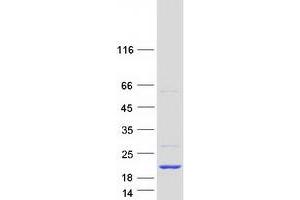 Validation with Western Blot