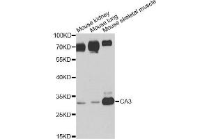 Western blot analysis of extracts of various cell lines, using CA3 antibody. (CA3 抗体)