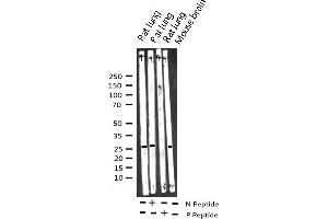 Western blot analysis of Phospho-14-3-3 zeta (Ser58) expression in various lysates (14-3-3 zeta 抗体  (pSer58))