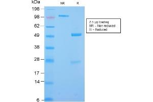 SDS-PAGE Analysis Purified Desmin Rabbit Recombinant Monoclonal Antibody (DES/2960R). (Recombinant Desmin 抗体)