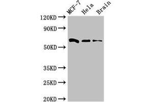 Western Blot Positive WB detected in: MCF-7 whole cell lysate, Hela whole cell lysate, Mouse brain tissue All lanes: SGO1 antibody at 3 μg/mL Secondary Goat polyclonal to rabbit IgG at 1/50000 dilution Predicted band size: 65, 36, 34, 32, 30, 61, 25 kDa Observed band size: 65 kDa