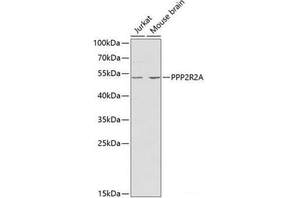 PPP2R2A 抗体