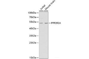 Western blot analysis of extracts of various cell lines using PPP2R2A Polyclonal Antibody at dilution of 1:1000. (PPP2R2A 抗体)