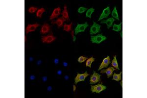 ABIN6259765 and ABIN6269299 staining HepG2 cells by IF/ICC. (ADAM17 抗体  (C-Term))