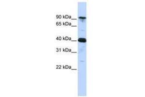 Image no. 1 for anti-Cysteinyl-tRNA Synthetase (CARS) (AA 756-805) antibody (ABIN6740660) (CARS 抗体  (AA 756-805))