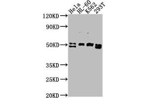 Western Blot Positive WB detected in: HeLa whole cell lysate, HL-60 whole cell lysate, K562 whole cell lysate, 293T whole cell lysate All lanes: DDX47 antibody at 1:2000 Secondary Goat polyclonal to rabbit IgG at 1/50000 dilution Predicted band size: 51, 46 kDa Observed band size: 51 kDa (DDX47 抗体  (AA 225-460))