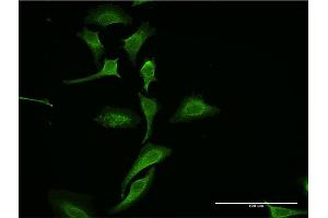 Immunofluorescence of monoclonal antibody to DKK1 on HeLa cell. (DKK1 抗体  (AA 171-266))