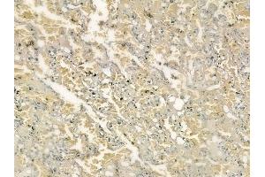 ABIN6261422 and ABIN6276611 at 1/100 staining human normal lung tissue by IHC-P. (DCI 抗体  (N-Term))
