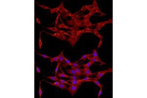 Immunofluorescence analysis of PC-12 cells using APC antibody (ABIN1678689, ABIN1678690, ABIN5664154 and ABIN6219837) at dilution of 1:100.
