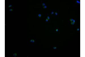 Regulator of G Protein Signaling 9 Binding Protein (RGS9BP) (AA 1-210) 抗体
