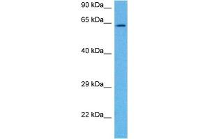 Western Blotting (WB) image for anti-Potassium Voltage-Gated Channel, KQT-Like Subfamily, Member 1 (KCNQ1) (N-Term) antibody (ABIN2776085)