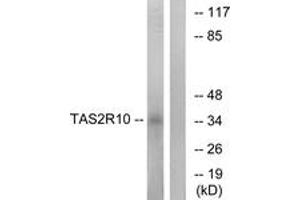 Western blot analysis of extracts from LOVO cells, using TAS2R10 Antibody. (TAS2R10 抗体  (AA 122-171))