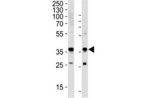 Western Blotting (WB) image for anti-Glyceraldehyde-3-Phosphate Dehydrogenase (GAPDH) (AA 62-91) antibody (ABIN3029800)