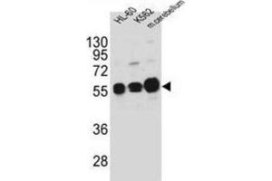 Western Blotting (WB) image for anti-Calcium/calmodulin-Dependent Protein Kinase IG (CAMK1G) antibody (ABIN3003081)
