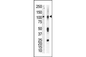 Western blot analysis of anti-PKCnu Pab (ABIN391014 and ABIN2841186) in lysate of HL60 cells stimulated with A (lane A) and mouse brain tissue lysate (lane B). (PRKD3 抗体  (AA 352-384))